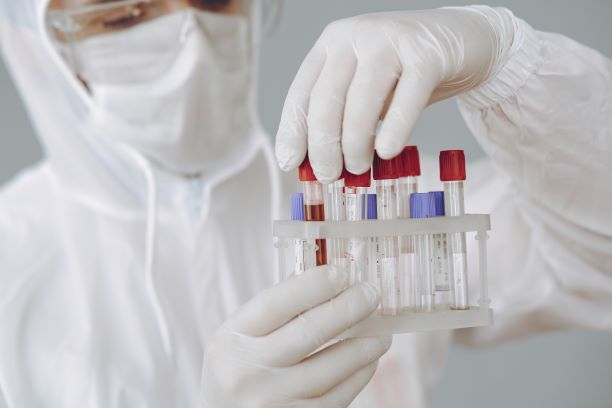 Zdjęcie ukazujące naukowca ubranego w kombinezon ochronny i badającego próbki krwi